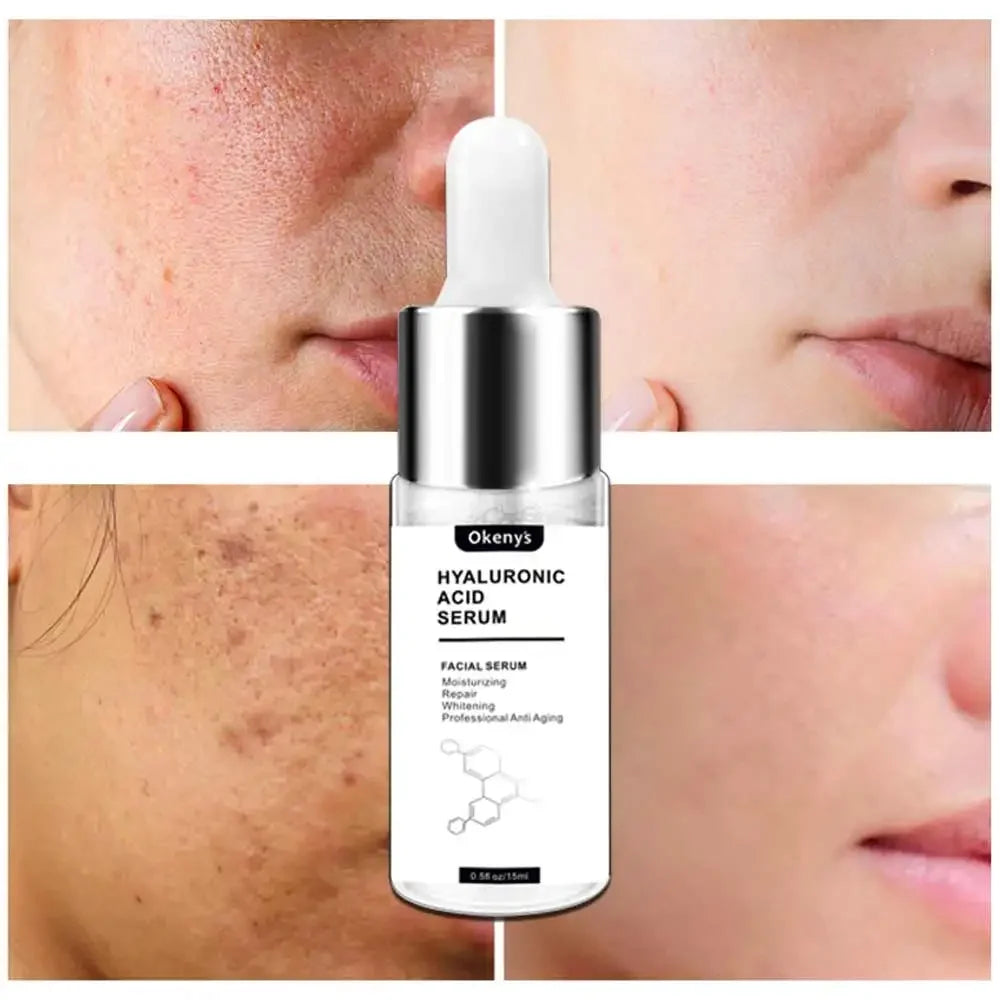Okeny's Hyaluronic Acid Face Serum - 15ml Moisturizing Elixir for Anti Aging & Skin Firming